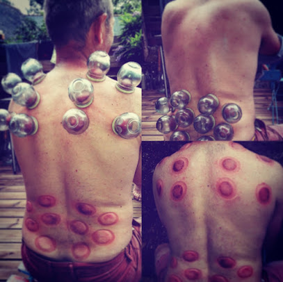 Photo Reflexologie 79 - Réflexothérapie